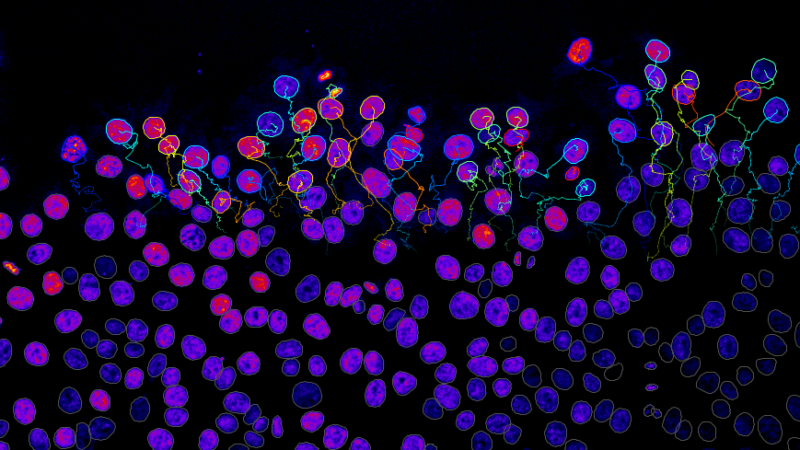 Purple and pink stained nuclei in a microscopic image of cells, enabling cell tracking